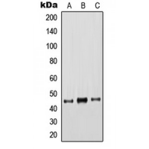 LifeSab™ Cytokeratin 18 Rabbit pAb (50 µl)