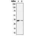 LifeSab™ Galectin 9 Rabbit pAb (50 µl)