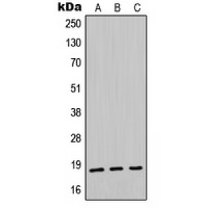 LifeSab™ Midkine Rabbit pAb (50 µl)