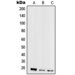 LifeSab™ Mammaglobin A Rabbit pAb (50 µl)