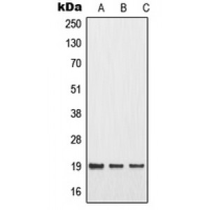 LifeSab™ MMP1 22k Rabbit pAb (50 µl)