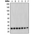 LifeSab™ MMP7 Rabbit pAb (50 µl)