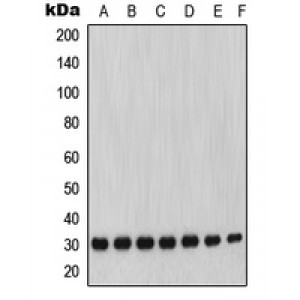 LifeSab™ MMP7 Rabbit pAb (50 µl)