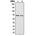 LifeSab™ MMP9 Rabbit pAb (50 µl)