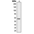 LifeSab™ MMP19 Rabbit pAb (50 µl)