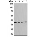 LifeSab™ MPG Rabbit pAb (50 µl)