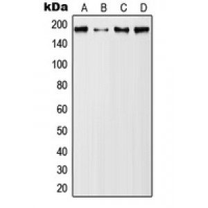 LifeSab™ MUC1 (pY1229) Rabbit pAb (50 µl)