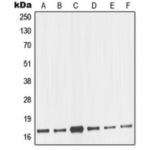 LifeSab™ nm23-H2 Rabbit pAb (50 µl)