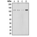 LifeSab™ NOTCH2 Rabbit pAb (50 µl)