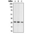 LifeSab™ NRL Rabbit pAb (50 µl)