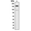 LifeSab™ TRK C Rabbit pAb (50 µl)