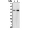 LifeSab™ NVL Rabbit pAb (50 µl)