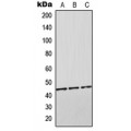 LifeSab™ Orosomucoid 2 Rabbit pAb (50 µl)