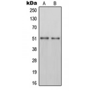 LifeSab™ PAH Rabbit pAb (50 µl)