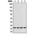 LifeSab™ CD279 Rabbit pAb (50 µl)