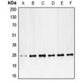 LifeSab™ PDGFB Rabbit pAb (50 µl)