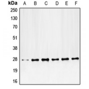 LifeSab™ PDGFB Rabbit pAb (50 µl)