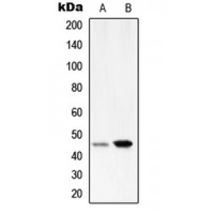 LifeSab™ Serpin A1 Rabbit pAb (50 µl)