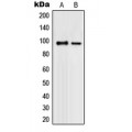 LifeSab™ PML Rabbit pAb (50 µl)