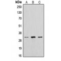 LifeSab™ Cathepsin A 32k Rabbit pAb (50 µl)