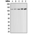 LifeSab™ PKC mu (pS910) Rabbit pAb (50 µl)