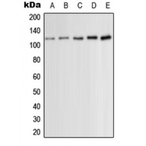 LifeSab™ PKC mu (pS910) Rabbit pAb (50 µl)