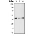 LifeSab™ PRKX Rabbit pAb (50 µl)