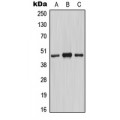 LifeSab™ MASP1 HC Rabbit pAb (50 µl)