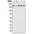 LifeSab™ Patched Rabbit pAb (50 µl)