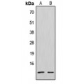 LifeSab™ CXCL12 Rabbit pAb (50 µl)