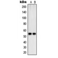 LifeSab™ SHB (pY246) Rabbit pAb (50 µl)