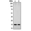 LifeSab™ Beta-synuclein Rabbit pAb (50 µl)