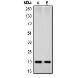 LifeSab™ Beta-synuclein Rabbit pAb (50 µl)