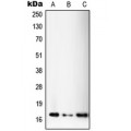 LifeSab™ SSBP1 Rabbit pAb (50 µl)