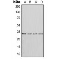 LifeSab™ DHEA-ST Rabbit pAb (50 µl)