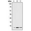 LifeSab™ XCL2 Rabbit pAb (50 µl)