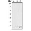 LifeSab™ Spasmolysin Rabbit pAb (50 µl)