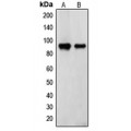 LifeSab™ Transglutaminase 2 Rabbit pAb (50 µl)