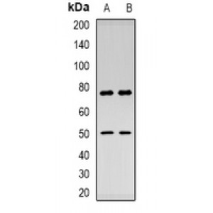 LifeSab™ CHID1 Rabbit pAb (50 µl)