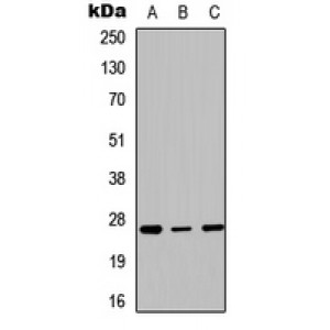 LifeSab™ HOXC6 Rabbit pAb (50 µl)