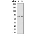 LifeSab™ NF-kappaB p65 (pT435) Rabbit pAb (50 µl)