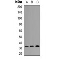 LifeSab™ RPS6 Rabbit pAb (50 µl)