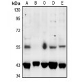 LifeSab™ SGK1/2 (pT256/253) Rabbit pAb (50 µl)