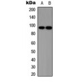 LifeSab™ SOX6 Rabbit pAb (50 µl)