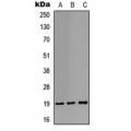 LifeSab™ STMN1 Rabbit pAb (50 µl)