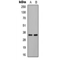 LifeSab™ C/EBP beta (pT235) Rabbit pAb (50 µl)