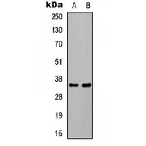 LifeSab™ C/EBP beta (pT235) Rabbit pAb (50 µl)