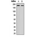 LifeSab™ EGFR Rabbit pAb (50 µl)