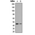 LifeSab™ GATA1 (pS142) Rabbit pAb (50 µl)