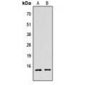 LifeSab™ Histone H2B (AcK5) Rabbit pAb (50 µl)